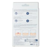 Cerave Parches Control Imperfecciones 22 uni